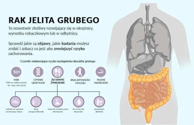 Rak jelita grubego objawy forum - co musisz wiedzieć, aby nie przegapić sygnałów