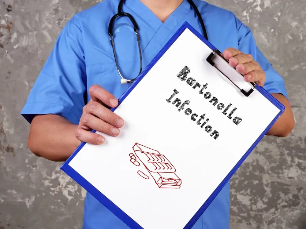 Bartonella objawy psychiczne: Jak rozpoznać niebezpieczne symptomy